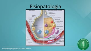 Fisiopatologia
 