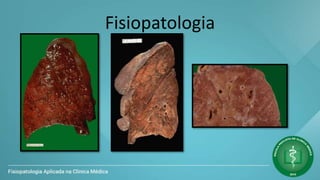 Fisiopatologia
 