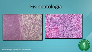 Fisiopatologia
 