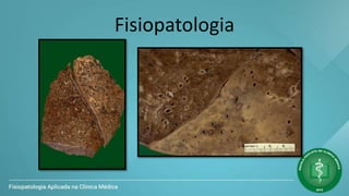 Fisiopatologia
 