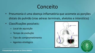 Conceito
• Pneumonia é uma doença inflamatória que acomete as porções
distais do pulmão (vias aéreas terminais, alvéolos e interstício)
• Classificações possíveis:
– Local de aquisição
– Tempo de evolução
– Tipo de comprometimento
– Agentes etiológico
 