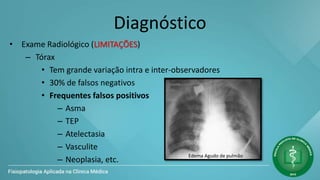 Diagnóstico
• Exame Radiológico (LIMITAÇÕES)
– Tórax
• Tem grande variação intra e inter-observadores
• 30% de falsos negativos
• Frequentes falsos positivos
– Asma
– TEP
– Atelectasia
– Vasculite
– Neoplasia, etc.
Edema Agudo de pulmão
 
