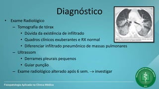 Diagnóstico
• Exame Radiológico
– Tomografia de tórax
• Dúvida da existência de infiltrado
• Quadros clínicos exuberantes e RX normal
• Diferenciar infiltrado pneumônico de massas pulmonares
– Ultrassom
• Derrames pleurais pequenos
• Guiar punção
– Exame radiológico alterado após 6 sem.  investigar
 