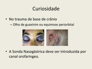 Curiosidade
• No trauma de base de crânio
– Olho de guaxinim ou equimose periorbital
• A Sonda Nasogástrica deve ser introduzida por
canal orofaringeo.
 