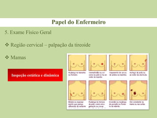 Papel do Enfermeiro
5. Exame Físico Geral
 Região cervical – palpação da tireoide
 Mamas
Inspeção estática e dinâmica
 