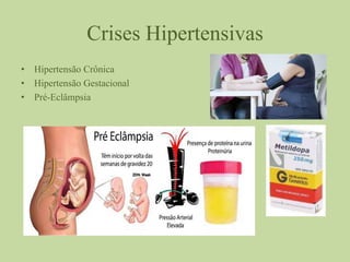 Crises Hipertensivas
• Hipertensão Crônica
• Hipertensão Gestacional
• Pré-Eclâmpsia
 