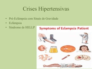 Crises Hipertensivas
• Pré-Eclâmpsia com Sinais de Gravidade
• Eclâmpsia
• Síndrome de HELLP
 