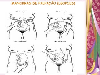 MANOBRAS DE PALPAÇÃO (LEOPOLD)
 