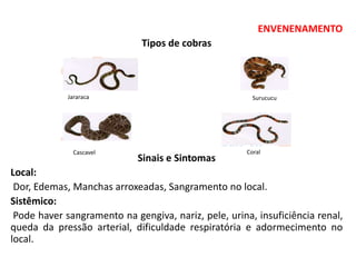 ENVENENAMENTO
Tipos de cobras
Sinais e Sintomas
Local:
Dor, Edemas, Manchas arroxeadas, Sangramento no local.
Sistêmico:
Pode haver sangramento na gengiva, nariz, pele, urina, insuficiência renal,
queda da pressão arterial, dificuldade respiratória e adormecimento no
local.
Jararaca Surucucu
Cascavel Coral
 