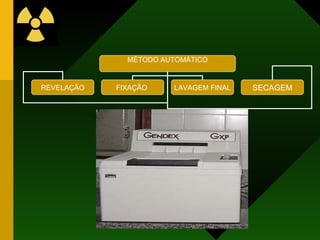 MÉTODO AUTOMÁTICO
REVELAÇÃO FIXAÇÃO LAVAGEM FINAL SECAGEM
 