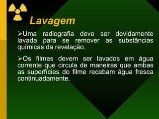Lavagem Uma radiografia deve ser devidamente lavada para se remover as substâncias químicas da revelação. Os filmes devem ser lavados em água corrente que circula de maneiras que ambas as superfícies do filme recebam água fresca continuadamente. 