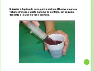 8- Aspire o líquido do copo com a seringa. Observe a cor e o
volume drenado e anote na folha de controle. Em seguida,
descarte o líquido no vaso sanitário.
 
