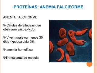 PROTEÍNAS: ANEMIA FALCIFORME ANEMIA FALCIFORME Células defeituosas que obstruem vasos.-> dor. Vivem mais ou menos 30 dias ->pouca vida útil. anemia hemolítica Transplante de medula 