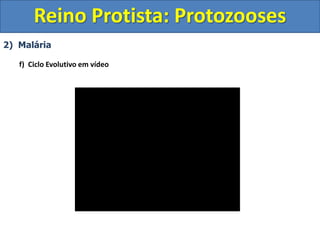 2) Malária
f) Ciclo Evolutivo em vídeo
Reino Protista: Protozooses
 