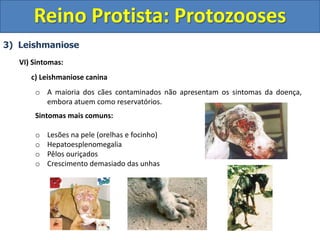 3) Leishmaniose
VI) Sintomas:
c) Leishmaniose canina
o A maioria dos cães contaminados não apresentam os sintomas da doença,
embora atuem como reservatórios.
Sintomas mais comuns:
o Lesões na pele (orelhas e focinho)
o Hepatoesplenomegalia
o Pêlos ouriçados
o Crescimento demasiado das unhas
Reino Protista: Protozooses
 