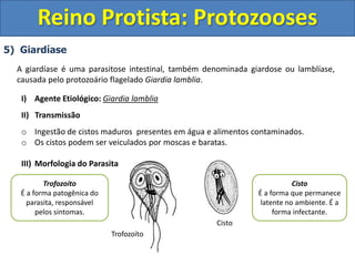 5) Giardíase
A giardíase é uma parasitose intestinal, também denominada giardose ou lamblíase,
causada pelo protozoário flagelado Giardia lamblia.
I) Agente Etiológico: Giardia lamblia
II) Transmissão
o Ingestão de cistos maduros presentes em água e alimentos contaminados.
o Os cistos podem ser veiculados por moscas e baratas.
III) Morfologia do Parasita
Reino Protista: Protozooses
Trofozoíto
Cisto
Trofozoíto
É a forma patogênica do
parasita, responsável
pelos sintomas.
Cisto
É a forma que permanece
latente no ambiente. É a
forma infectante.
 