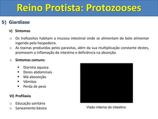 5) Giardíase
V) Sintomas
o Os trofozoítos habitam a mucosa intestinal onde se alimentam do bolo alimentar
ingerido pelo hospedeiro.
o As toxinas produzidas pelos parasitas, além da sua multiplicação constante destes,
promovem a inflamação do intestino e deficiência na absorção.
o Sintomas comuns:
 Diarréia aquosa
 Dores abdominais
 Má abosorção
 Vômitos
 Perda de peso
VI) Profilaxia
o Educação sanitária
o Saneamento básico
Reino Protista: Protozooses
Visão interna do intestino
 