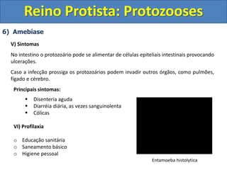 6) Amebíase
V) Sintomas
No intestino o protozoário pode se alimentar de células epiteliais intestinais provocando
ulcerações.
Caso a infecção prossiga os protozoários podem invadir outros órgãos, como pulmões,
fígado e cérebro.
Principais sintomas:
 Disenteria aguda
 Diarréia diária, as vezes sanguinolenta
 Cólicas
VI) Profilaxia
o Educação sanitária
o Saneamento básico
o Higiene pessoal
Reino Protista: Protozooses
Entamoeba histolytica
 