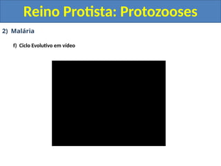 2) Malária
f) Ciclo Evolutivo em vídeo
Reino Protista: Protozooses
 