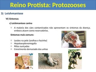 3) Leishmaniose
VI) Sintomas:
c) Leishmaniose canina
o A maioria dos cães contaminados não apresentam os sintomas da doença,
embora atuem como reservatórios.
Sintomas mais comuns:
o Lesões na pele (orelhas e focinho)
o Hepatoesplenomegalia
o Pêlos ouriçados
o Crescimento demasiado das unhas
Reino Protista: Protozooses
 