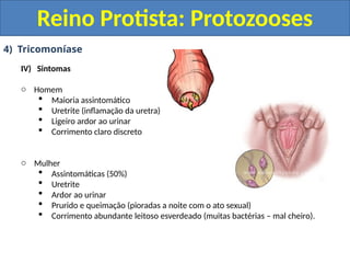 4) Tricomoníase
IV) Sintomas
o Homem
 Maioria assintomático
 Uretrite (inflamação da uretra)
 Ligeiro ardor ao urinar
 Corrimento claro discreto
o Mulher
 Assintomáticas (50%)
 Uretrite
 Ardor ao urinar
 Prurido e queimação (pioradas a noite com o ato sexual)
 Corrimento abundante leitoso esverdeado (muitas bactérias – mal cheiro).
Reino Protista: Protozooses
 