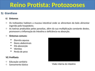 5) Giardíase
V) Sintomas
o Os trofozoítos habitam a mucosa intestinal onde se alimentam do bolo alimentar
ingerido pelo hospedeiro.
o As toxinas produzidas pelos parasitas, além da sua multiplicação constante destes,
promovem a inflamação do intestino e deficiência na absorção.
o Sintomas comuns:
 Diarréia aquosa
 Dores abdominais
 Má abosorção
 Vômitos
 Perda de peso
VI) Profilaxia
o Educação sanitária
o Saneamento básico
Reino Protista: Protozooses
Visão interna do intestino
 