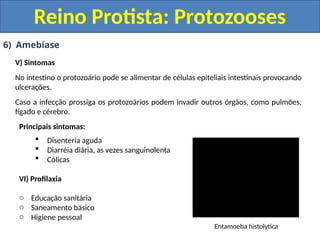 6) Amebíase
V) Sintomas
No intestino o protozoário pode se alimentar de células epiteliais intestinais provocando
ulcerações.
Caso a infecção prossiga os protozoários podem invadir outros órgãos, como pulmões,
fígado e cérebro.
Principais sintomas:
 Disenteria aguda
 Diarréia diária, as vezes sanguinolenta
 Cólicas
VI) Profilaxia
o Educação sanitária
o Saneamento básico
o Higiene pessoal
Reino Protista: Protozooses
Entamoeba histolytica
 