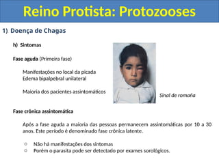 1) Doença de Chagas
h) Sintomas
Fase aguda (Primeira fase)
Manifestações no local da picada
Edema bipalpebral unilateral
Maioria dos pacientes assintomáticos
Fase crônica assintomática
Após a fase aguda a maioria das pessoas permanecem assintomáticas por 10 a 30
anos. Este período é denominado fase crônica latente.
o Não há manifestações dos sintomas
o Porém o parasita pode ser detectado por exames sorológicos.
Reino Protista: Protozooses
Sinal de romaña
 
