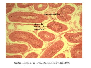 Túbulos seminíferos de testículo humano observados a 100x Lúmen do túbulo seminífero espermatozóides 