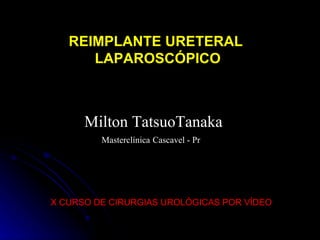 X CURSO DE CIRURGIAS UROLÓGICAS POR VÍDEO Milton TatsuoTanaka Masterclínica   Cascavel - Pr REIMPLANTE URETERAL LAPAROSCÓPICO 