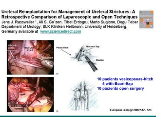 10 pacients vesicopsoas-hitch
   4 with Boari-flap
10 pacients open surgery
 