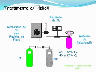 Tratamento c/ Heliox

                       Analisador
                        de O2

 Misturador de
      O2
      com
  Medidor de                                    Máscara
     Fluxo                                         de
                                               Nebulização


                              60 a 80% He
                              40 a 20% O2
        O2               He
                                    Hollman G. Crit Care Med
                                             1998
 