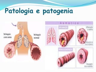 Patologia e patogenia
 