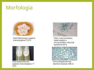 Morfologia
Forma leveduriforme
(Gomori-Grocott, 400 x)
Fase leveduriforme:
aspecto macroscópico / T
35°C
Fase filamentosa: aspecto
macroscópico/T 25°C
Hifas, macroconídeos
tuberculados e
microconídeos. (Azul de
lactofenol 40 x)
 