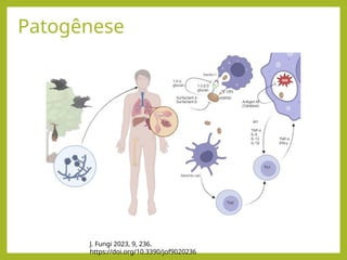 Patogênese
J. Fungi 2023, 9, 236.
https://doi.org/10.3390/jof9020236
 