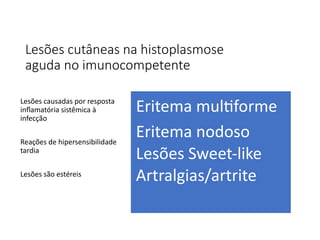 Lesões cutâneas na histoplasmose
aguda no imunocompetente
Lesões causadas por resposta
inflamatória sistêmica à
infecção
Reações de hipersensibilidade
tardia
Lesões são estéreis
Eritema multiforme
Eritema nodoso
Lesões Sweet-like
Artralgias/artrite
 