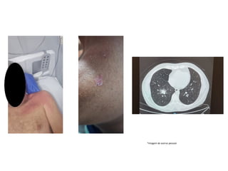 *Imagem de acervo pessoal
 