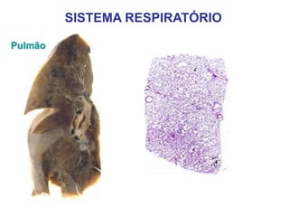 Pulmão
SISTEMA RESPIRATÓRIO
 