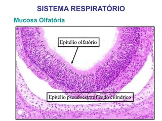 Mucosa Olfatória
SISTEMA RESPIRATÓRIO
Epitélio olfatório
Epitélio pseudoestratificado cilíndrico
 