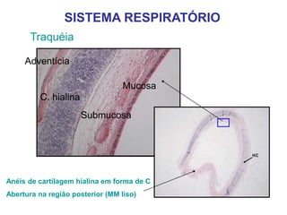 Traquéia
SISTEMA RESPIRATÓRIO
Mucosa
Submucosa
C. hialina
Adventícia
Anéis de cartilagem hialina em forma de C
Abertura na região posterior (MM liso)
 