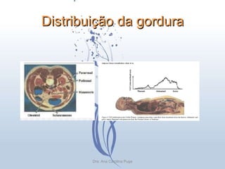 Distribuição da gordura Dra. Ana Carolina Puga 