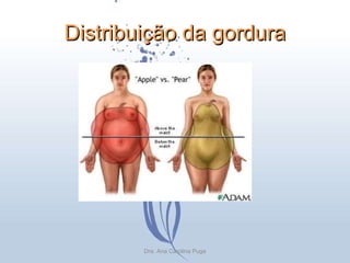 Distribuição da gordura Dra. Ana Carolina Puga 