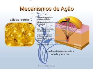 Mecanismos de Ação Células “gordas” Pulso focalizado atingindo a camada gordurosa Dra. Ana Carolina Puga 