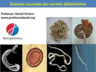 Doenças causadas por vermes platelmintos
Professor: Daniel Pereira
www.professordaniel.org

 