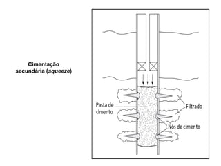 Cimentação
secundária (squeeze)
 