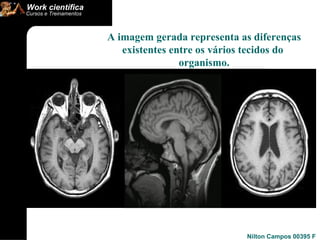 A imagem gerada representa as diferenças existentes entre os vários tecidos do  organismo. 