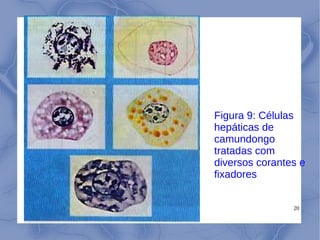 20
Figura 9: Células
hepáticas de
camundongo
tratadas com
diversos corantes e
fixadores
 