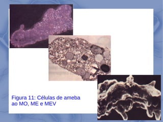 24
Figura 11: Células de ameba
ao MO, ME e MEV
 