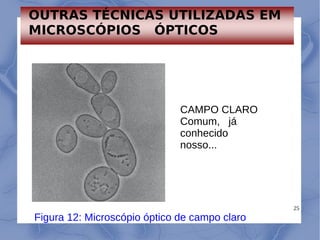 25
CAMPO CLARO
Comum, já
conhecido
nosso...
Figura 12: Microscópio óptico de campo claro
OUTRAS TÉCNICAS UTILIZADAS EM
MICROSCÓPIOS ÓPTICOS
 