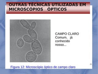 25
CAMPO CLARO
Comum, já
conhecido
nosso...
Figura 12: Microscópio óptico de campo claro
OUTRAS TÉCNICAS UTILIZADAS EM
MIC...
